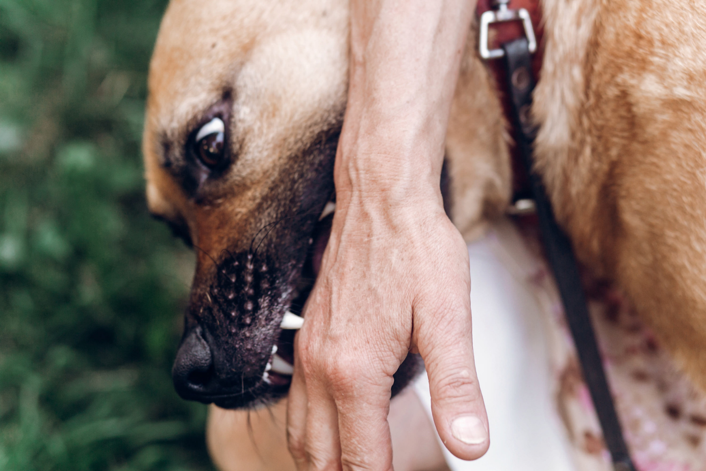 Dog Bite Injuries
